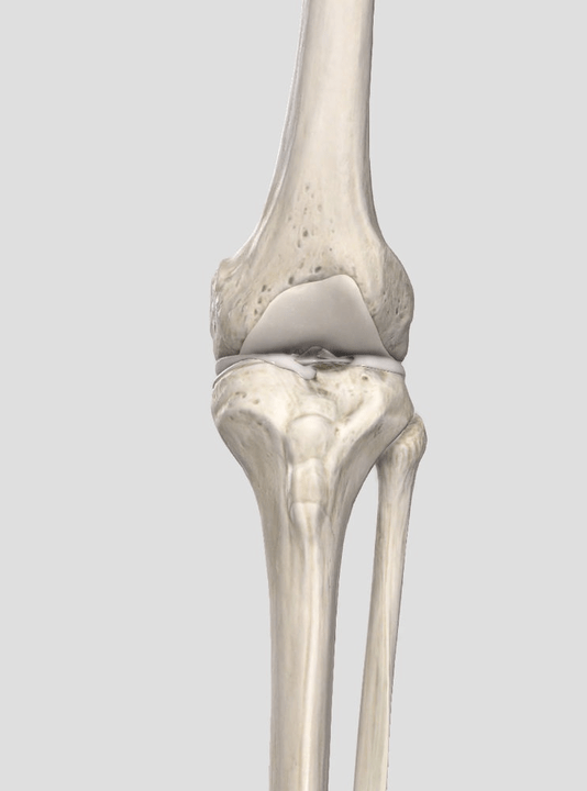 Wear of the cartilage