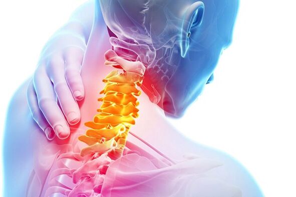 The causes of cervical osteochondrosis