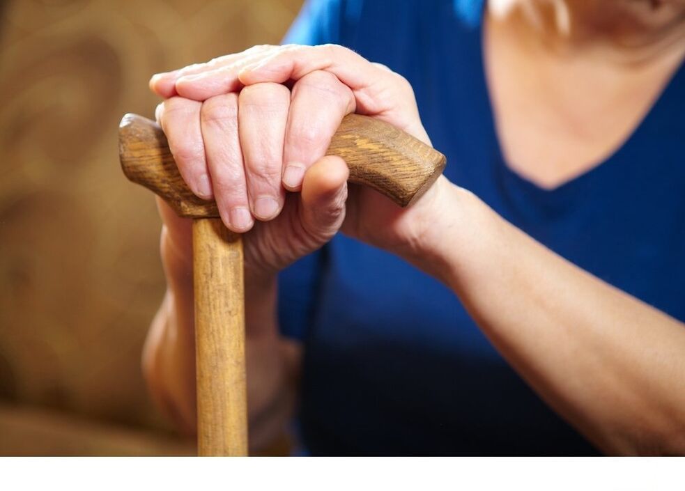 Use of canthritis against coxarthrosis